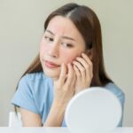 Recognizing the Early Signs of Rosacea